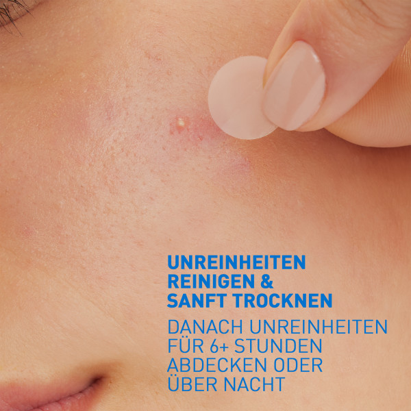CERAVE Anti-Unreinheiten Patches 22 Stk