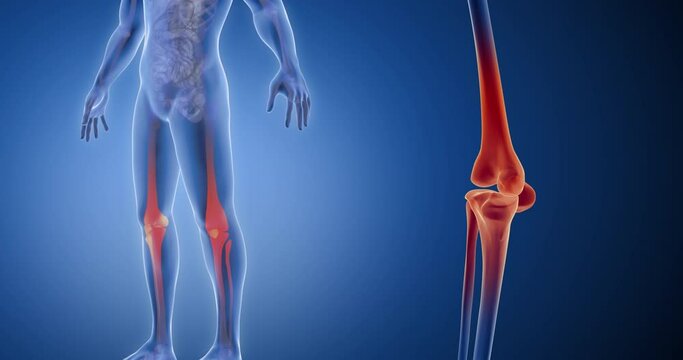 Patella Component