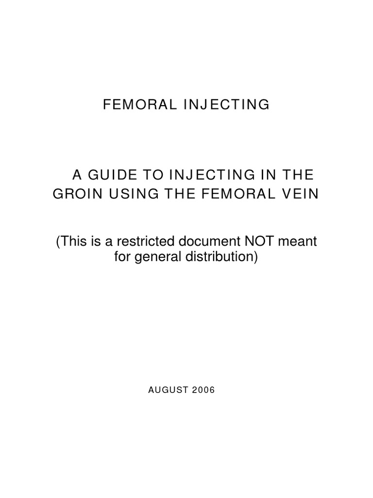 Femoral Milling Guide