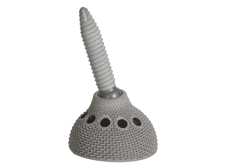 CASE 7023130 LEGACY ILIAC SET SCREW MOD