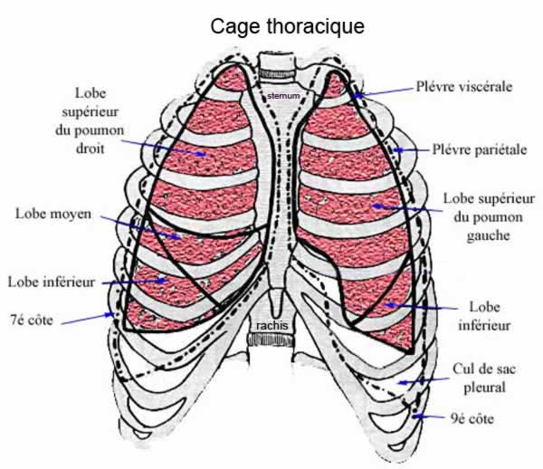 CAGE X3832745 PSR PK ANAT CAGE 14X17X5