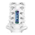 PLATE 6190050 ANTERIOR CERVICAL 50MM