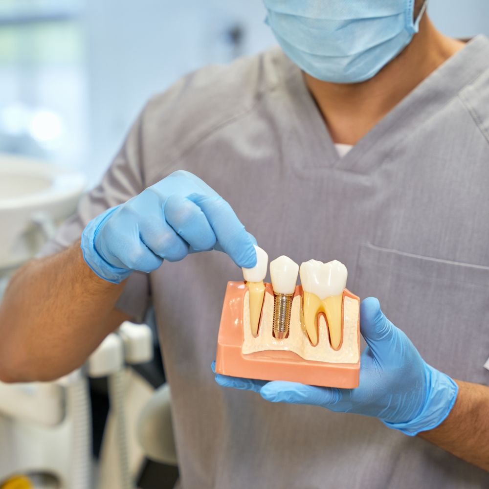 LID 7574010L FAS IMPLANT