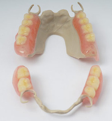 ROD 7579050 PERC PEEK