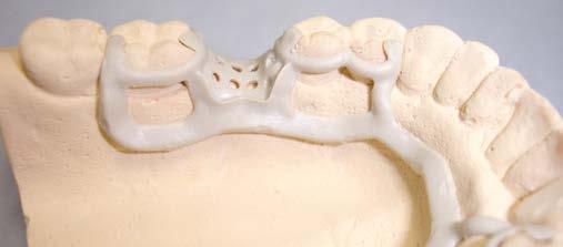 ROD 7579040 PERC PEEK