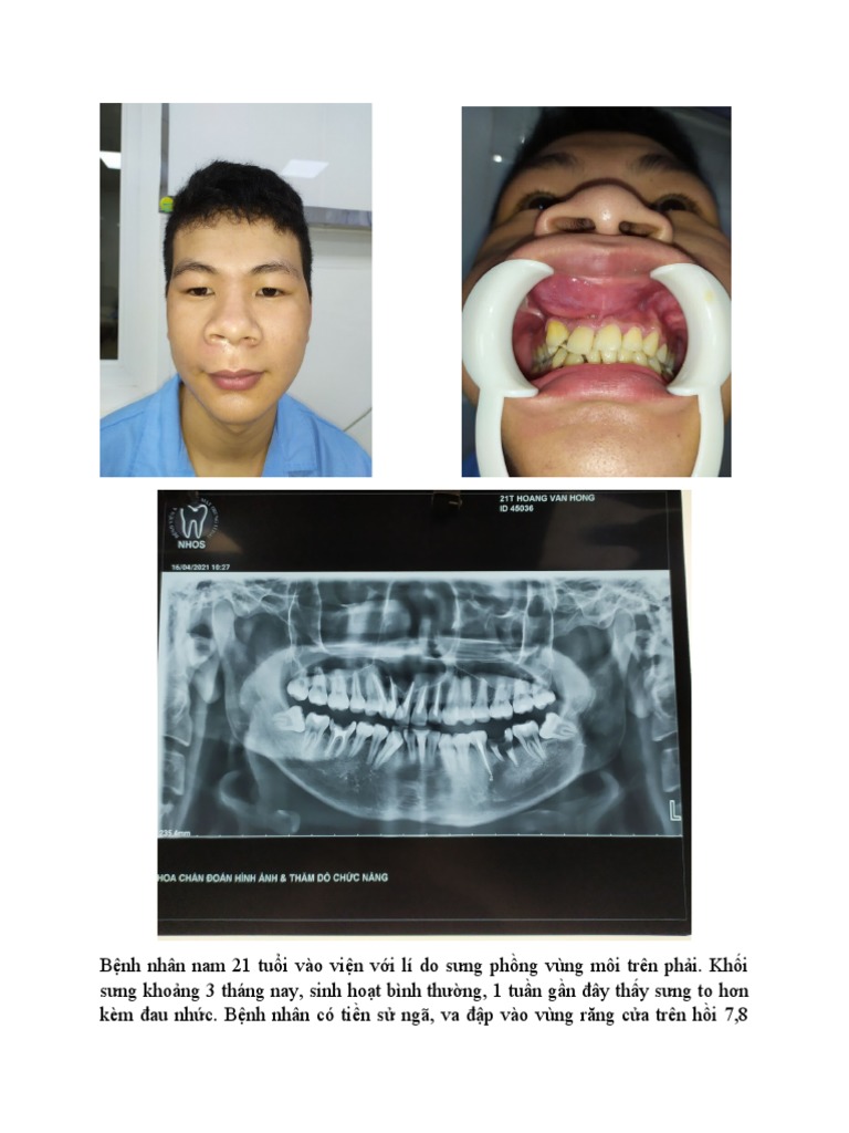 CASE 7449006 LEGACY 4.5 INSTRUMT CASE 1