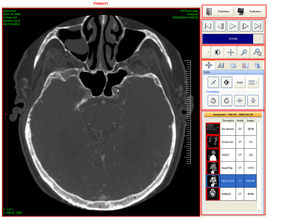 SFTWR KIT 9733933 DICOM SOFTWARE Q/R