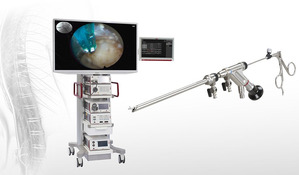 PROBE 9734433 RIGHT LUMBAR TACTILE