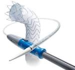 STENT GRAFT VAMF3030C150TE CAPTIVIA