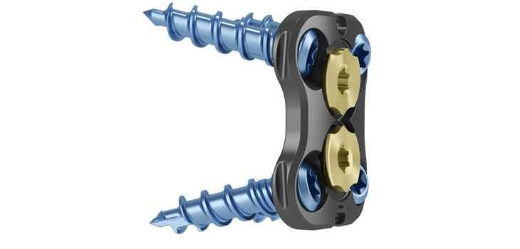 SCREW 7713517 ZEVO VAR SD 3.5MM X 17MM