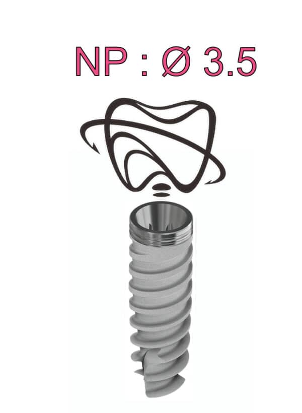 IMPLANT G6626526 NP LORDO 6MMX15MMX12MM