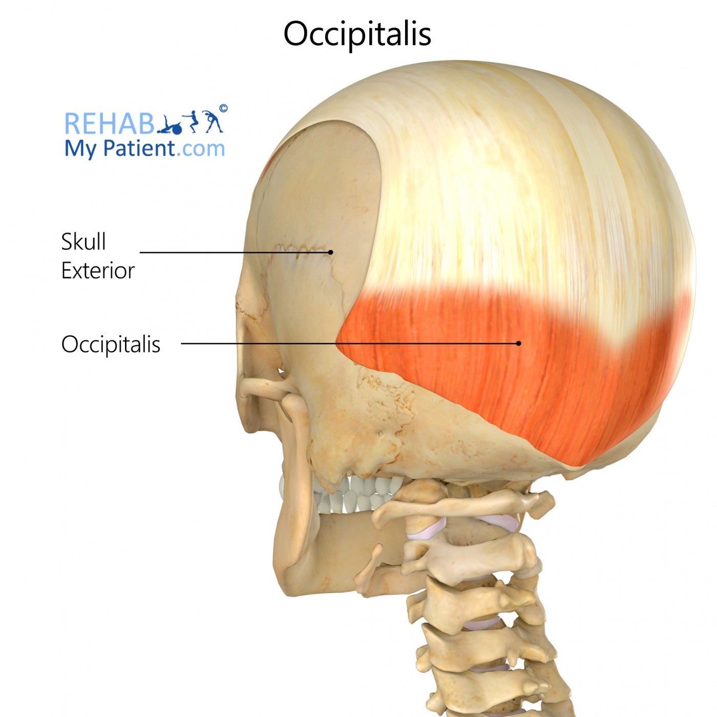 OCCIPITAL 3600210 ADJUSTABLE CCM 3.5X200