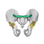 PLATE 8619210 RIGHT ILLIO SACRAL