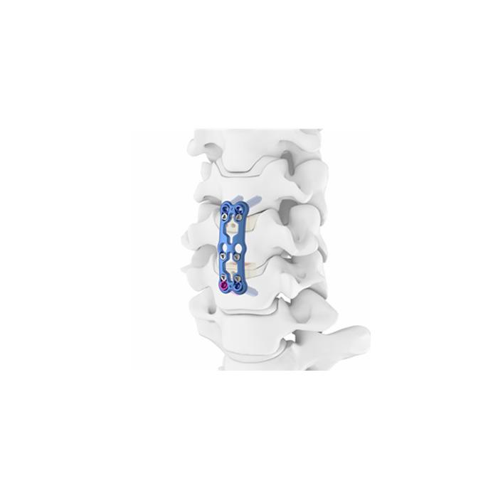 PLATE 876-125 25MM ANTERIOR CERVICAL