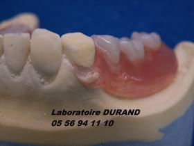 PROSTHESIS 0500 FLEX H/A CENTERED TOTAL