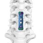PLATE 976-130 30MM ANTERIOR CERVICAL
