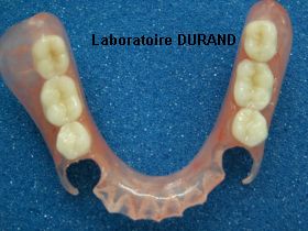 PROSTHESIS 0568 MILLEN FLEX H/A NOTCHED