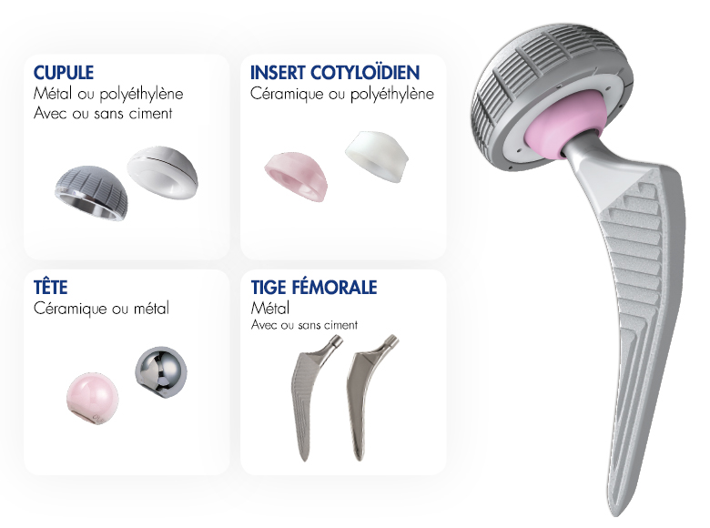 PROSTHESIS 1112090 H/A PARTIAL 90DEG ROU