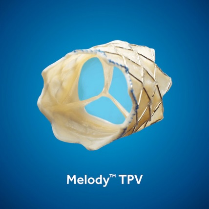 VALVE PB1016 MELODY TPV 16MM