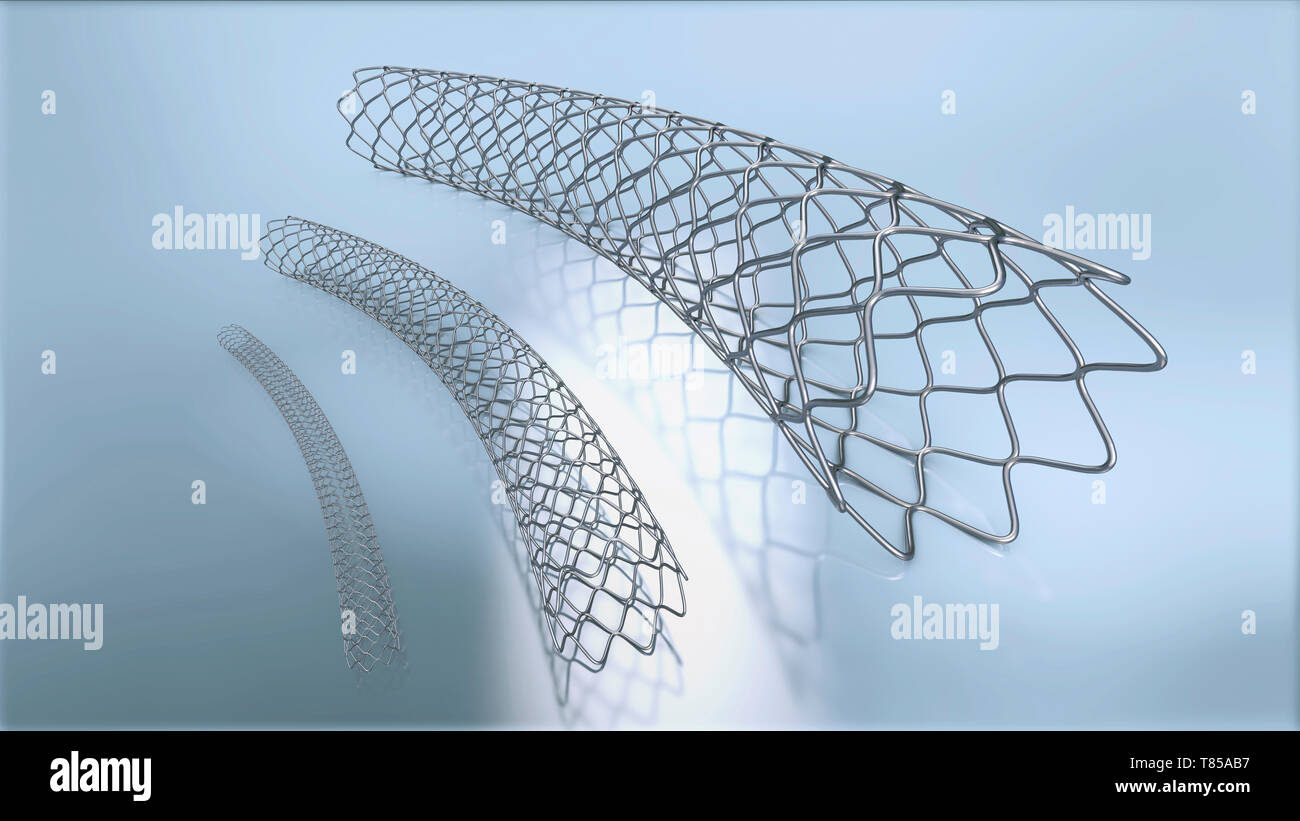 STENT ONYXNG50015X ONYX 5.00X15RX