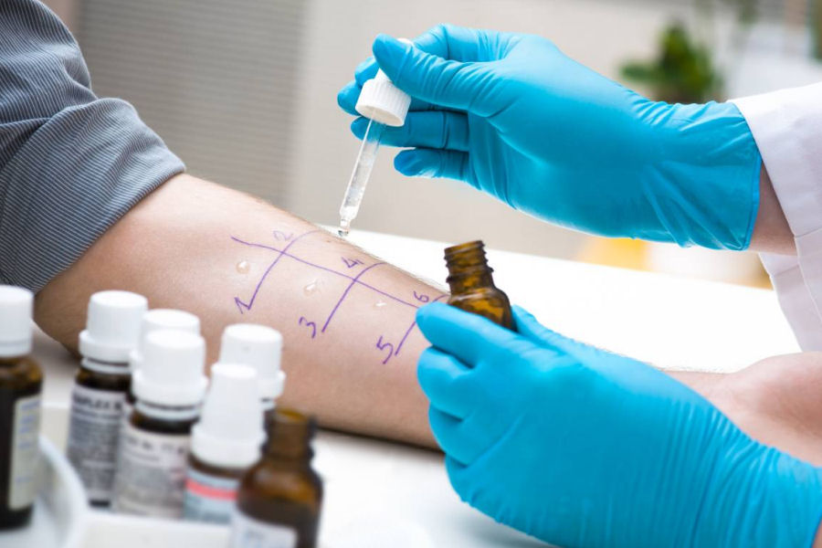 Prick-Test Mixtura Graminea-Cerealis, Pricktestlösung