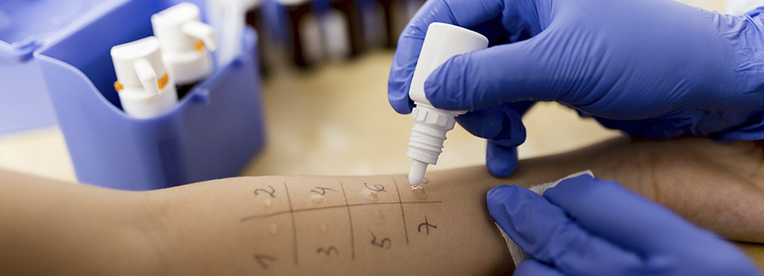 Prick-Test Poa pratensis, Pricktestlösung