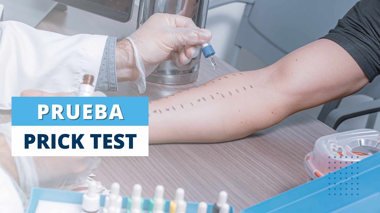 Prick-Test Populus alba, Pricktestlösung