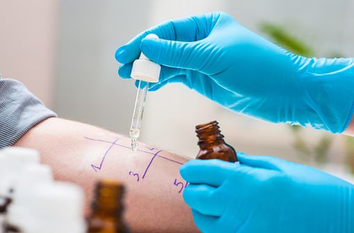 Acarizax, Lyophilisat zum Einnehmen