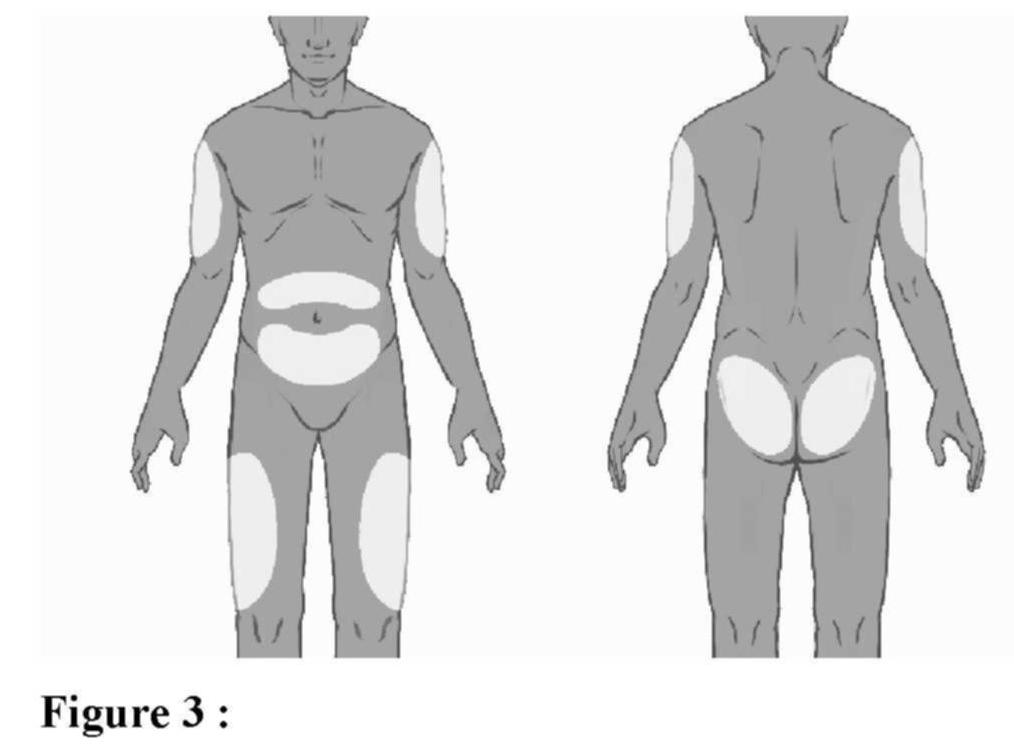 BUVIDAL Depot sol inj 24 mg/0.48ml ser pré