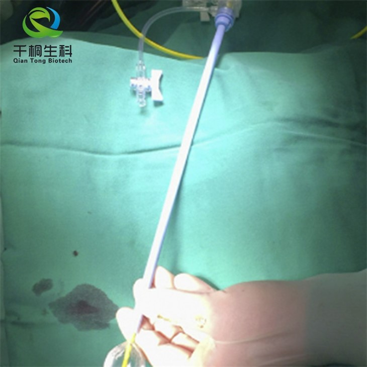 Upj Occlusion Balloon Catheter, 1 Each
