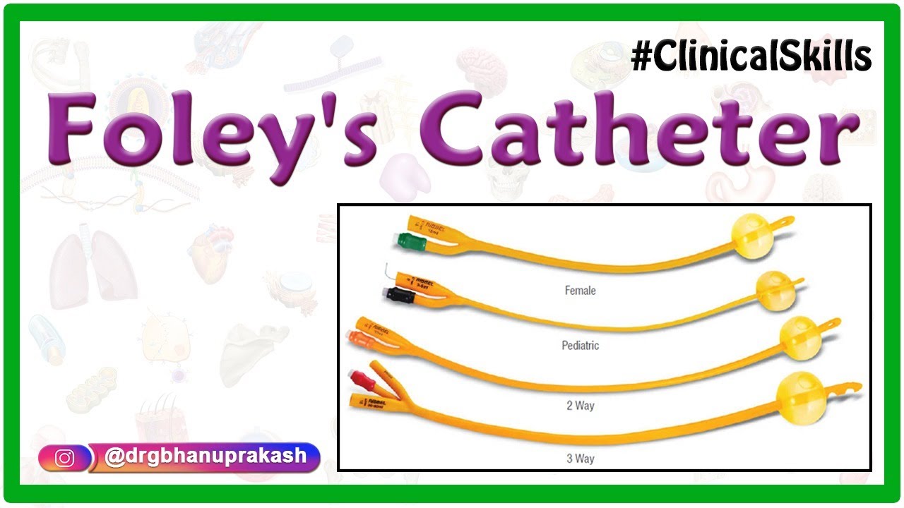 Female Urethral Balloon Catheter, 1 Each