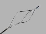 Nforce Nitinol Helical Stone Extractor, 1 Each