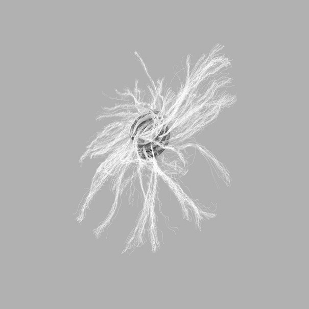 Mreye Embolization Coil, 1 Each