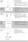 Lead Extraction Byrd Workstation Femoral Intravascular Retriever Set, 1 Set