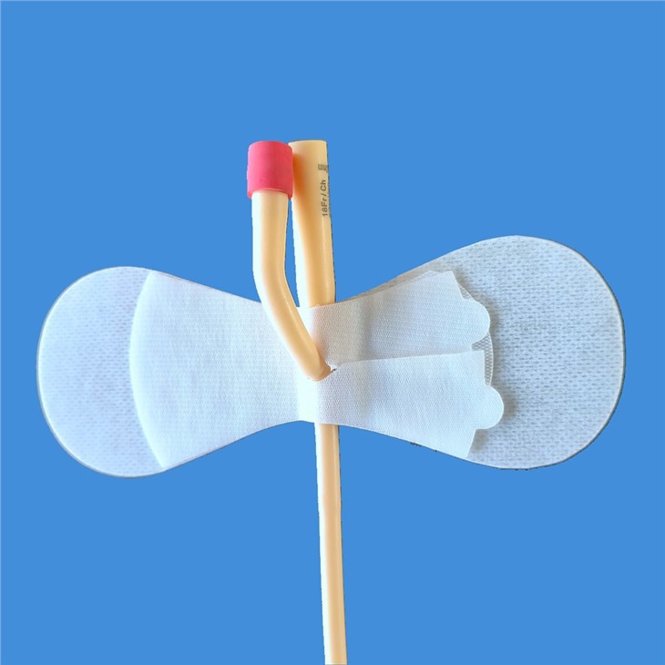 Soehendra Universal Catheter, 1 Each
