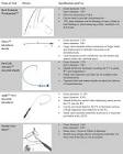 Lead Extraction Curved Inner Femoral Sheath, 1 Each