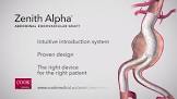 Zenith Alpha Spiral-z Endovascular Leg, 1 Each