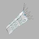 Zenith Fenestrated Aaa Endovascular Graft Proximal Body, 1 Each