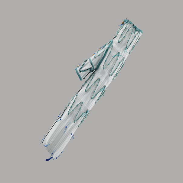 Bifurcated Iliac Sidebranch Endovascular Graft, 1 Each