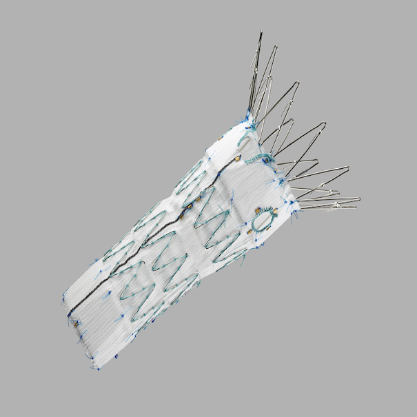 Zenith Fenestrated Aaa Endovascular Graft Proximal Body, 1 Each