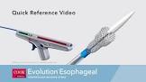 Evolution® Esophageal Controlled-release Stent - Partially Covered, 1 Each