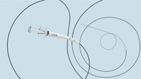 Cantata 2.8 Superselective Microcatheter, 1 Each