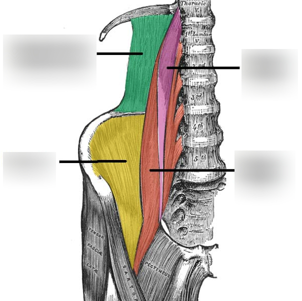 IMPACTOR A99130862 POSTERIOR WALL 6-25MM