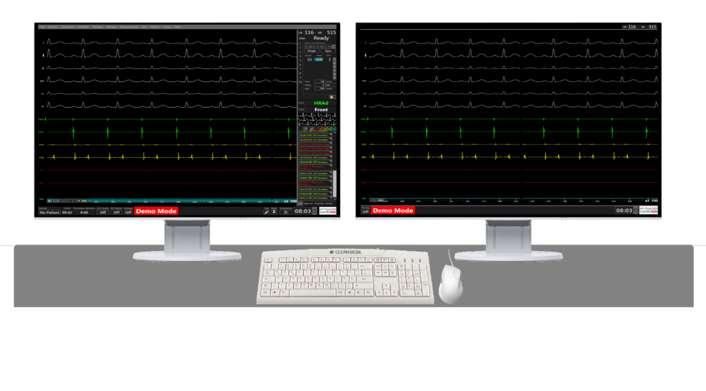 STATIONARY SYSTEM MDT09 EP-TRACER 102