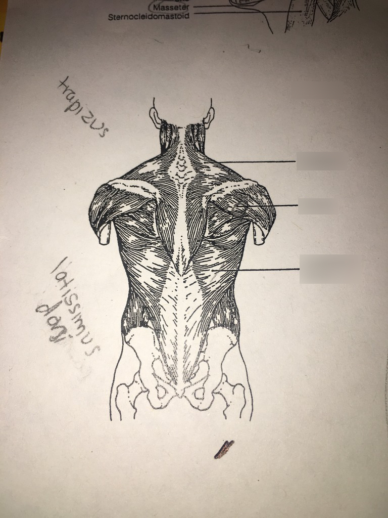 POSTERIOR BODY RESECTOR 7480514 25MM