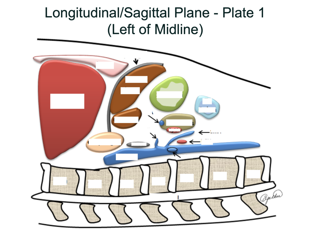 PLATE G7759971 LP OC MIDLINE M-SHAPED M