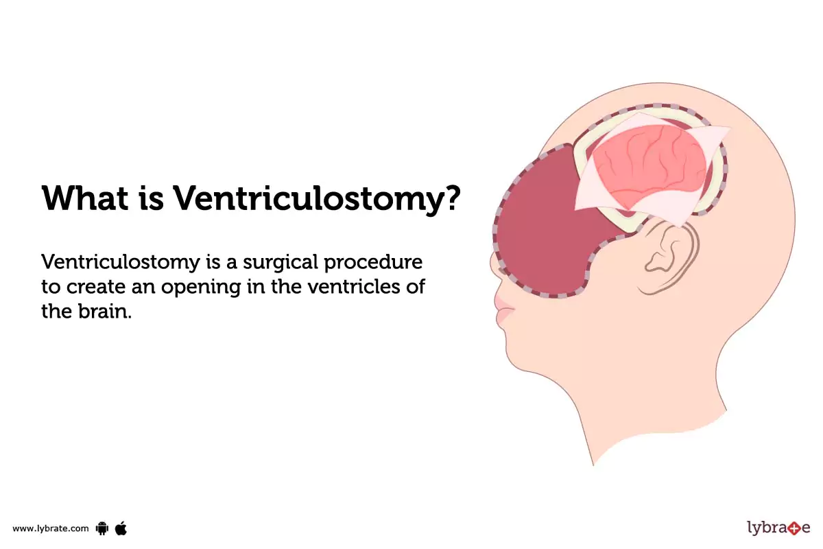 RES 44200 VENTRICULOSTOMY BH 6MM REG IMP