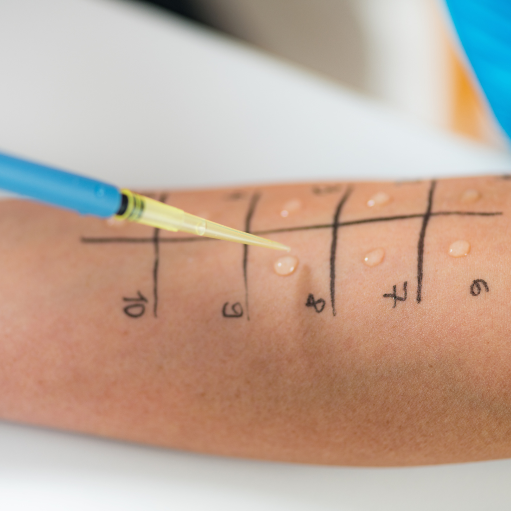 Prick-Test Palinurus vulgaris, Pricktestlösung