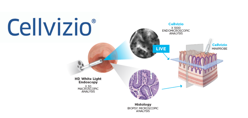 Cellvizio® Confocal Laser Endomicroscopy System, 1 Each